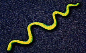 Image: Colored Transmission Electron Micrograph (TEM) showing a Treponema pallidum bacterium (Photo courtesy of Alfred Pasieka / Science Photo Library).